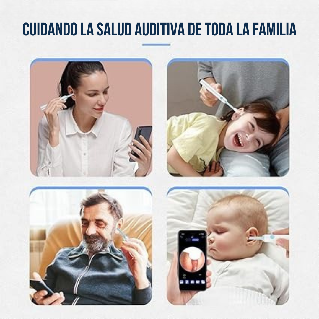 👂 Aurix Pro™ – Limpieza de Oídos con Cámara HD 🌟